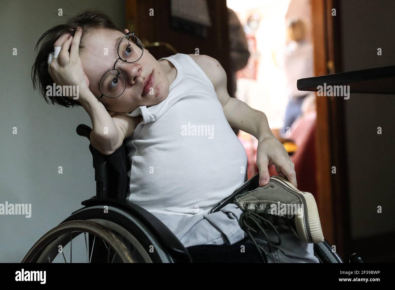 Brittle Bone Disease High Resolution Stock Photography and Images Alamy