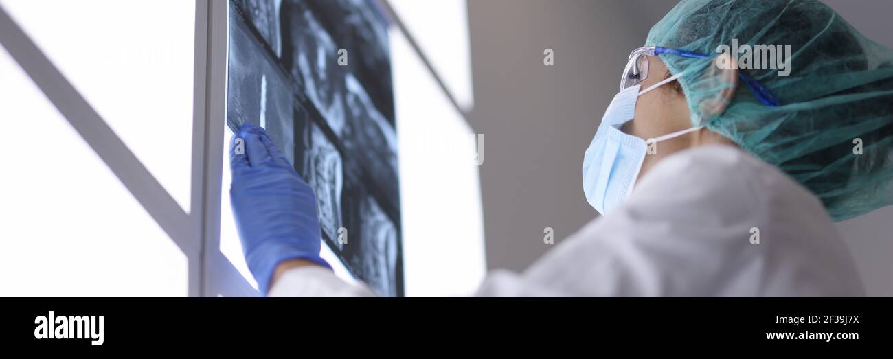 Xray of spinal cord hi-res stock photography and images - Alamy