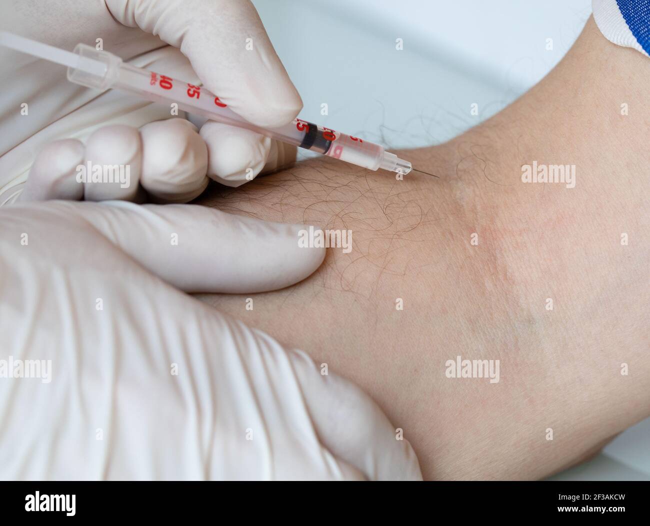 Medical assistant is about to administrate medication in the arm of a man. Closeup Stock Photo