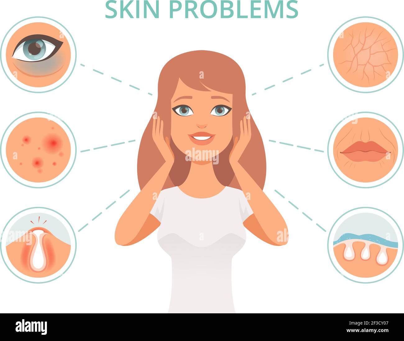 Skin problems. Beauty woman scrub care face infection darkness scrubs oily face cleanse vector symbols Stock Vector