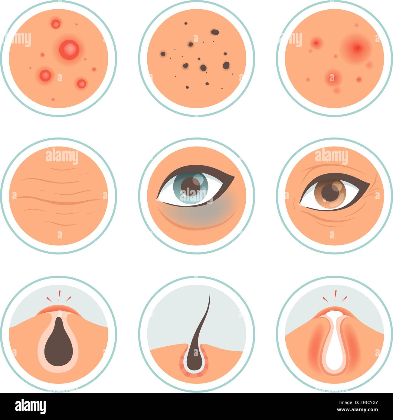 Skin problems. Dark circles woman infection spot washing skin oily face ages pore cleanse vector medical icon Stock Vector