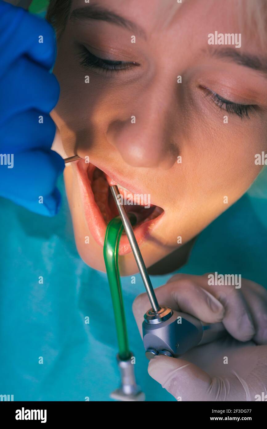 Closeup clean dental examination on a woman's teeth in a dental office