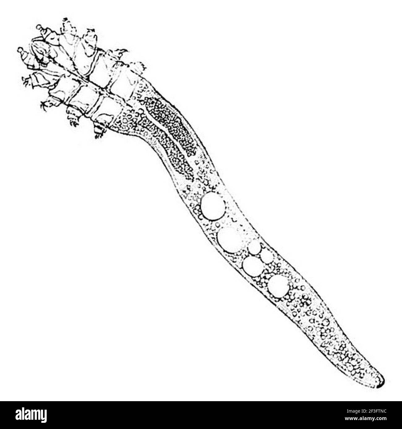 Железница угревая demodex folliculorum. Железница угревая возбудитель демодекоза. Клещ demodex folliculorum микроскоп. Угревая железница что это такое. Демодекс железница угревая.