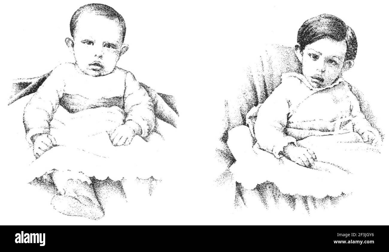 a-little-boy-at-the-ages-of-six-and-eighteen-months-stock-photo-alamy