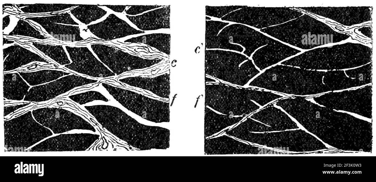 Bruised muscles with and without massage Stock Photo Alamy