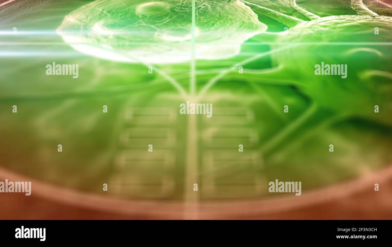 Human brain tumour cells hi-res stock photography and images - Alamy