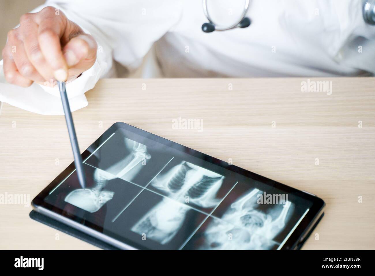 Xray plates on digital table and telemedicine consultation Stock Photo