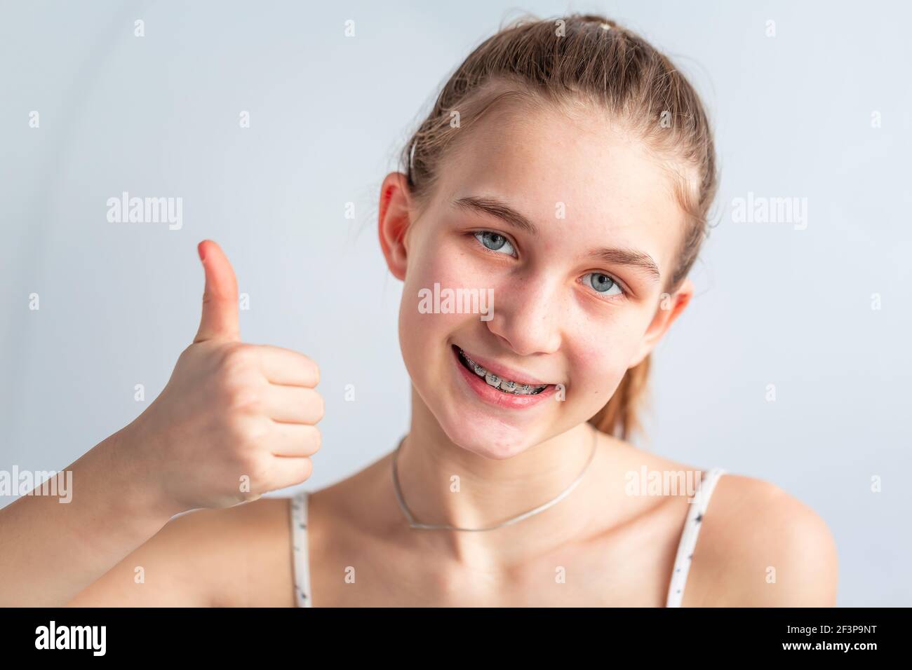 Teenage girl smiling in orthodontic brackets showing thumb up. Girl with braces on teeth. Orthodontic Treatment. Stock Photo