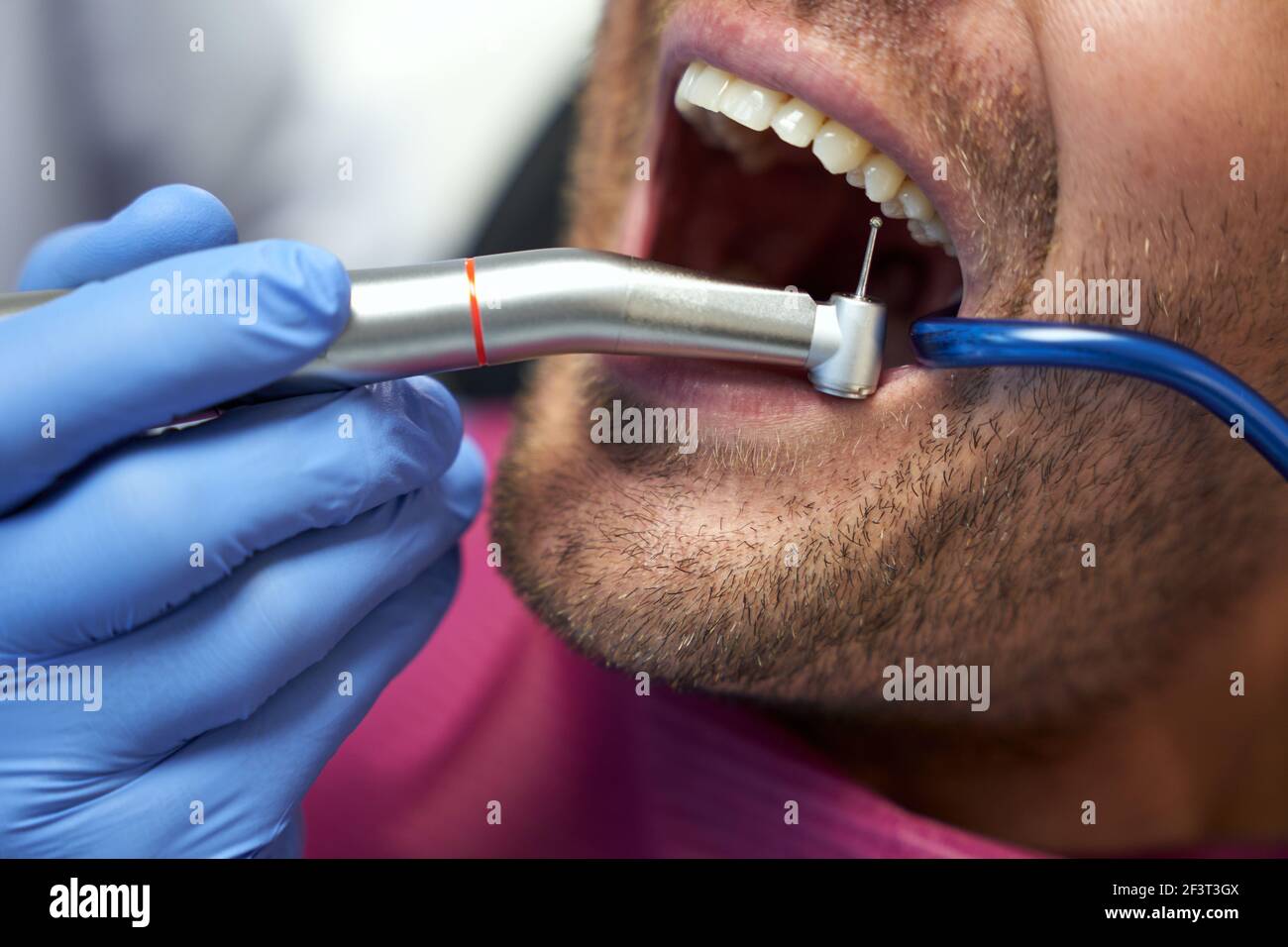 Exquisite Get Teeth Fixed Background Digital Art Exquisite Get Teeth Fixed Background Digital Art