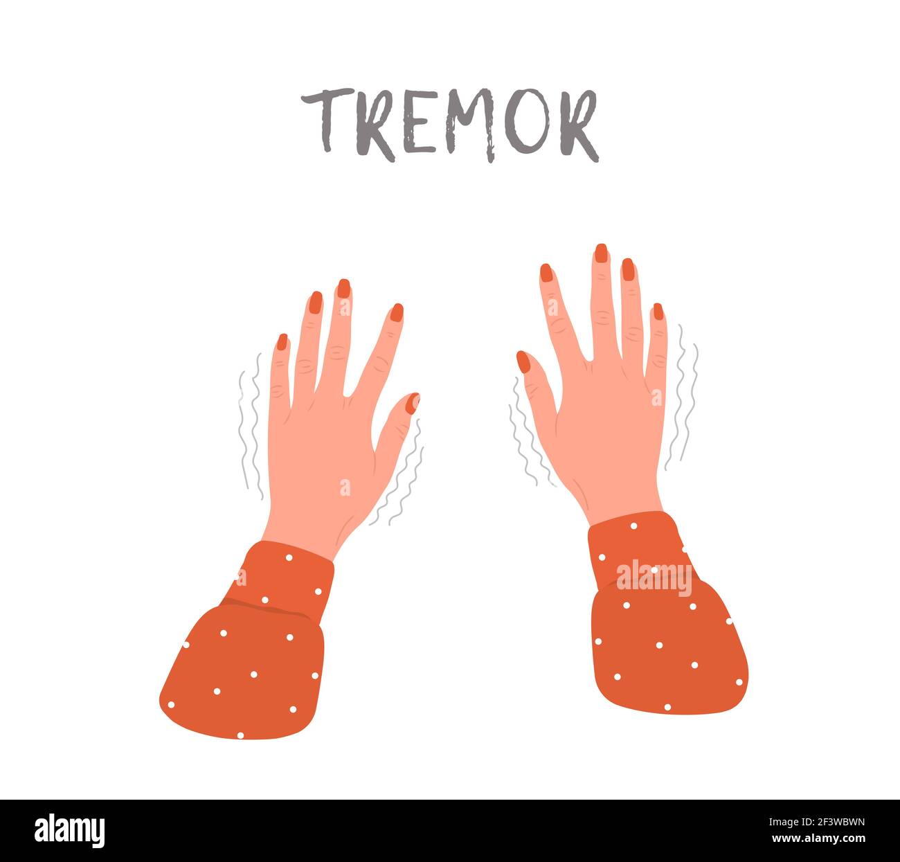 Tremor hands. Parkinson disease. Female arms with nails. Physiological stress symptoms. Vector illustration in flat cartoon style Stock Vector