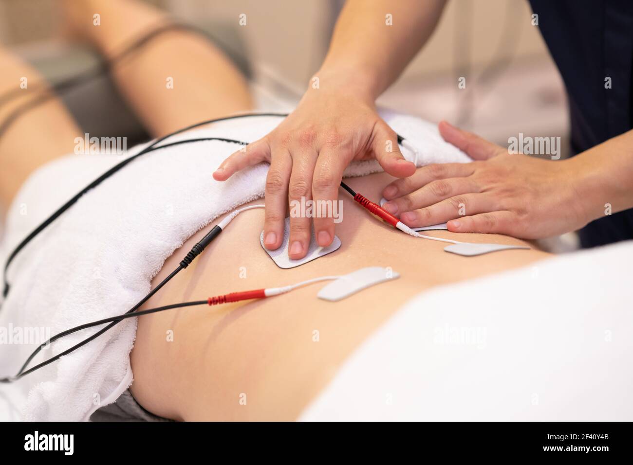 Physiotherapist applying electro stimulation in physical therapy to a young woman.. Electro stimulation in physical therapy to a young woman Stock Photo