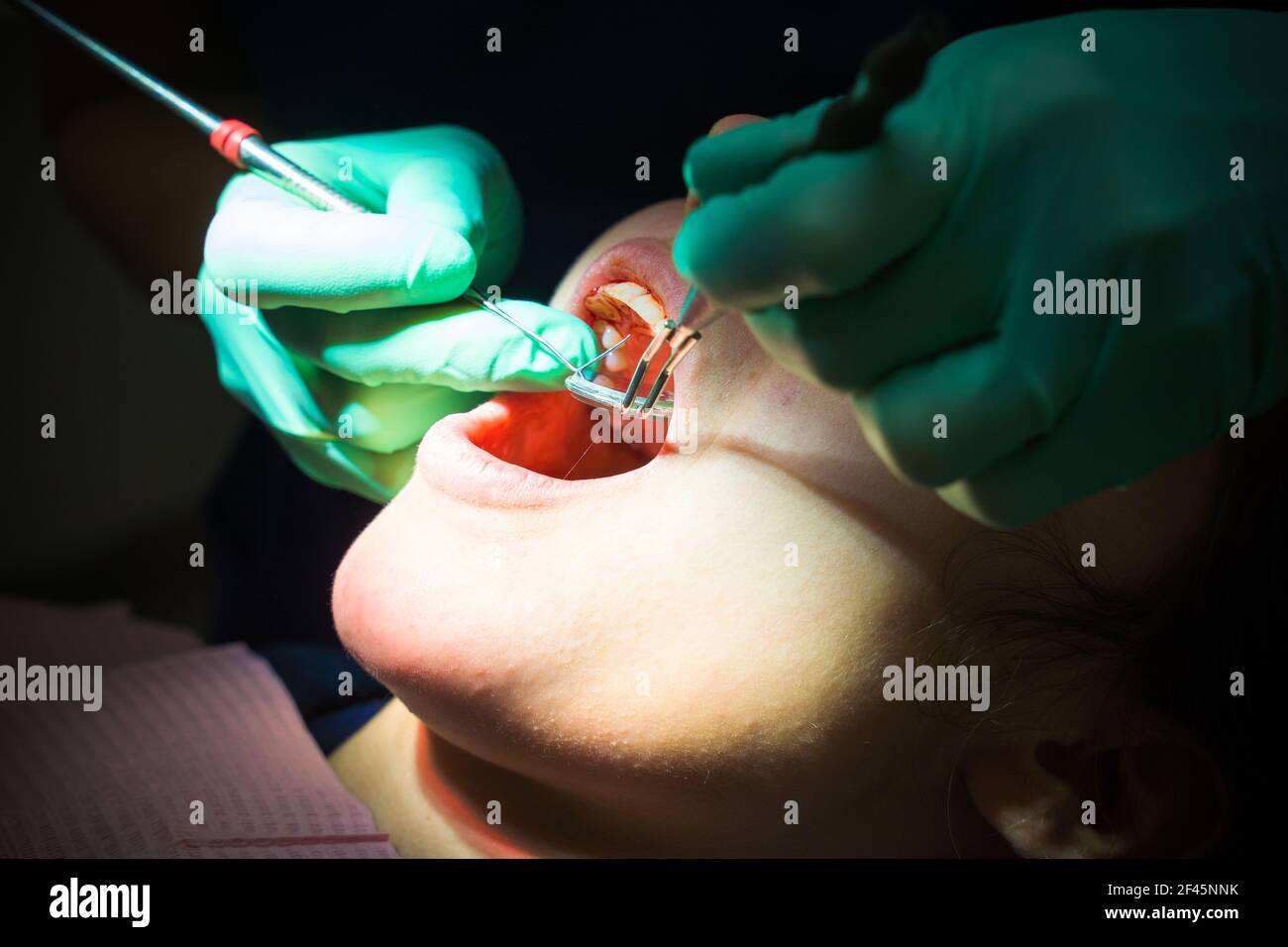 European female patient on dentist appointment during dental procedure.  Stock Photo