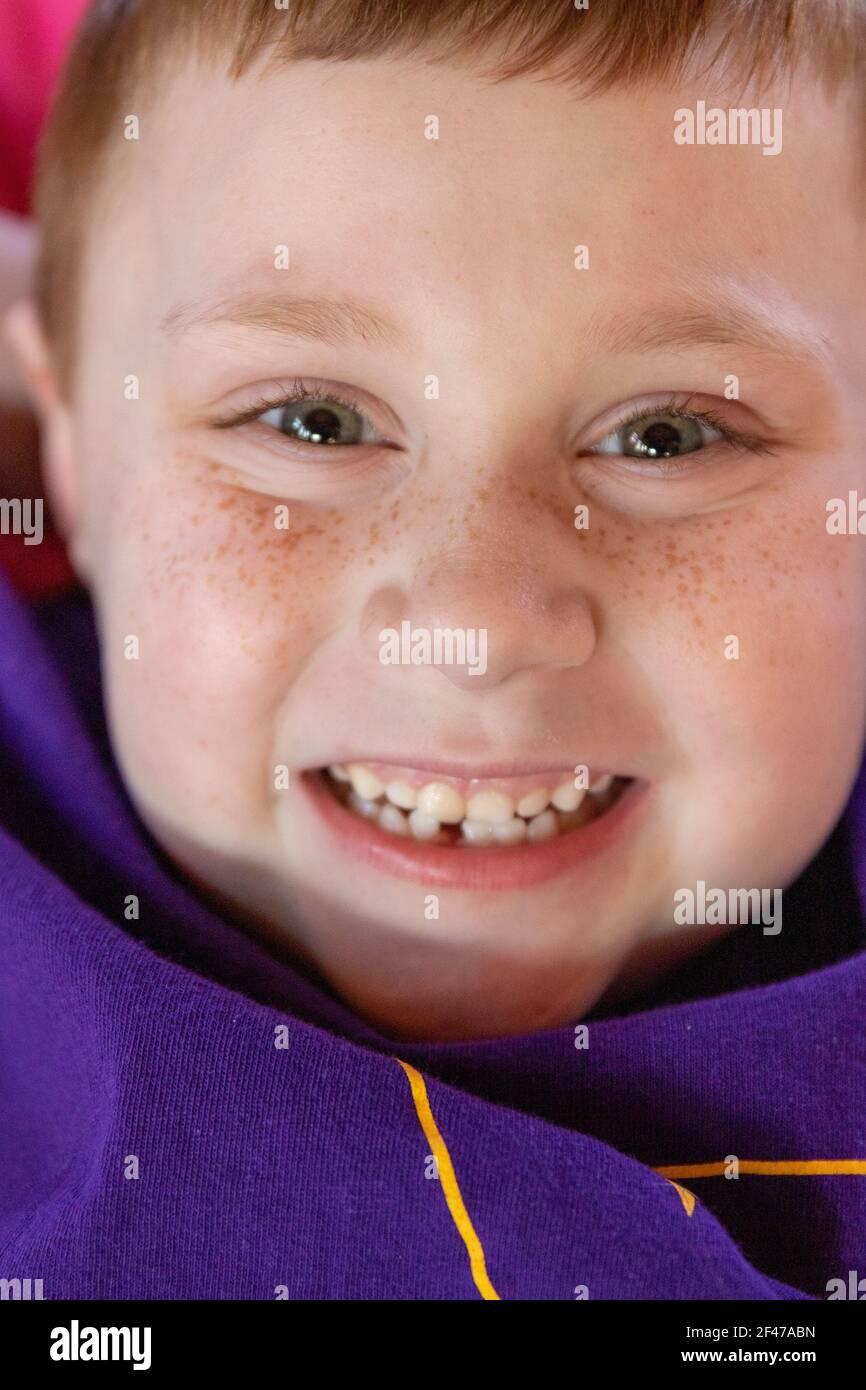 Boy's first tooth missing Stock Photo
