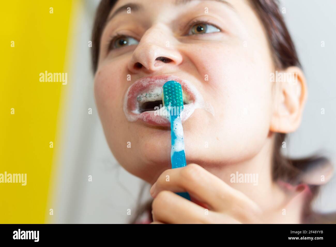 Girl with dental braces and brackets holding toothbrush for dental hygiene Stock Photo Alamy