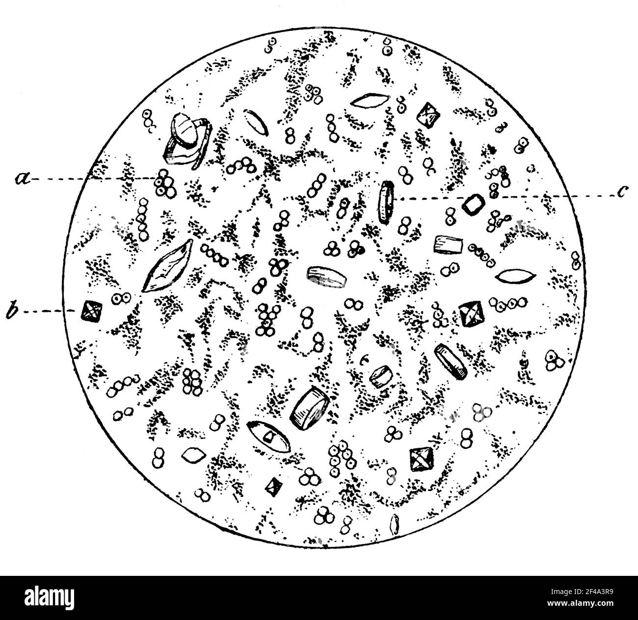 Crystals of Uric acid (a), Calcium oxalate (b) and fermentation of the fungus (c) under the microscope. Illustration of the 19th century. Germany. White background. Stock Photo