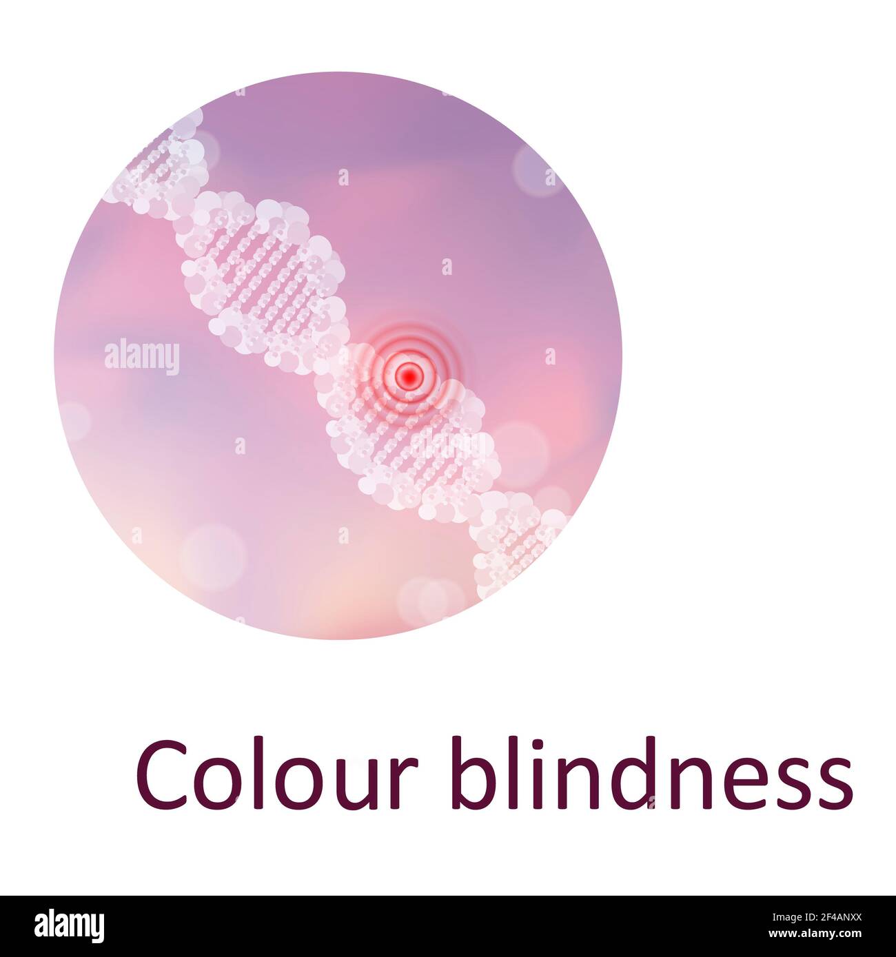 Colour blindness, illustration Stock Photo