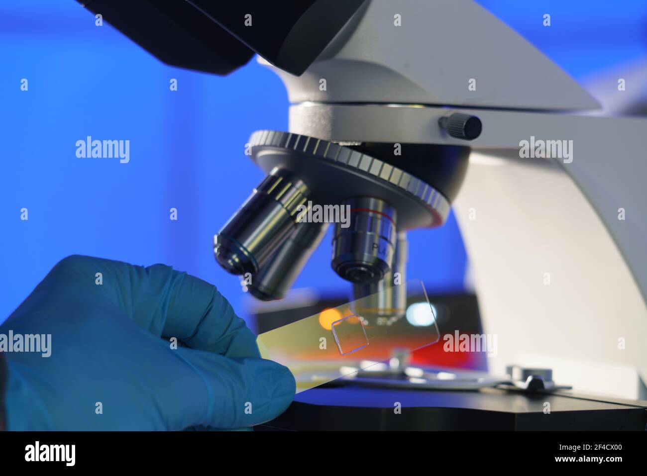 Glass slide with a tissue in hand and a scientific microscope. Screening biopsy sample in medical laboratory Stock Photo