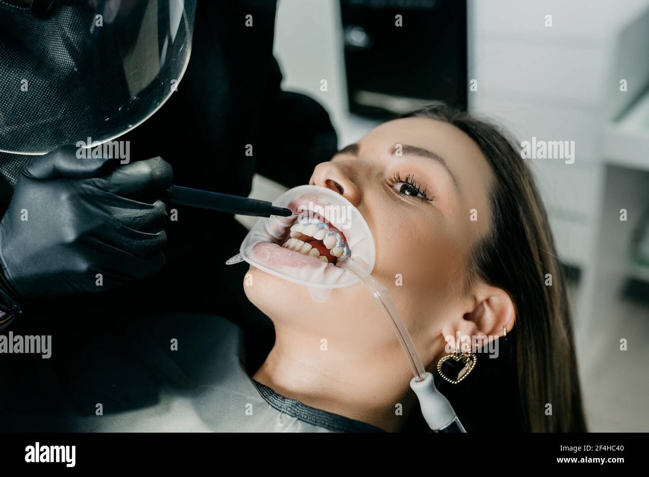 Crop unrecognizable dentist uputting photosensitive paste while treating teeth of female with saliva ejector and retractor in mouth Stock Photo