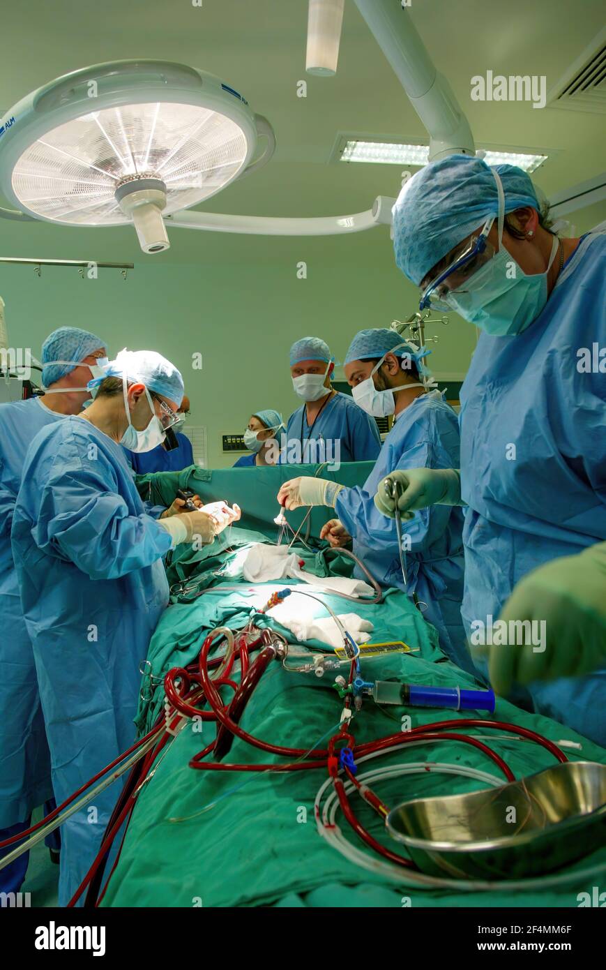 Consultant cardiologist Ciro Campanella (wearing optics), and his team, performing heart surgery at Edinburgh Royal Infirmary, Edinburgh, Scotland Stock Photo