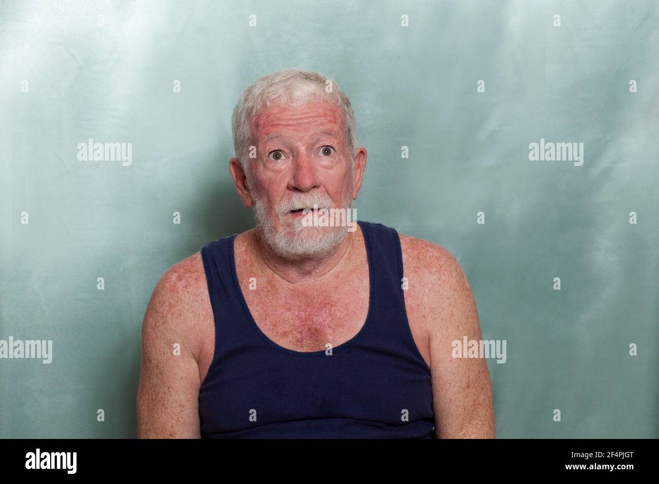 An old caucasian man dressed in a blue singlet and with a lot of sun damage and skin cancers and with a surprised expression on his face. Stock Photo