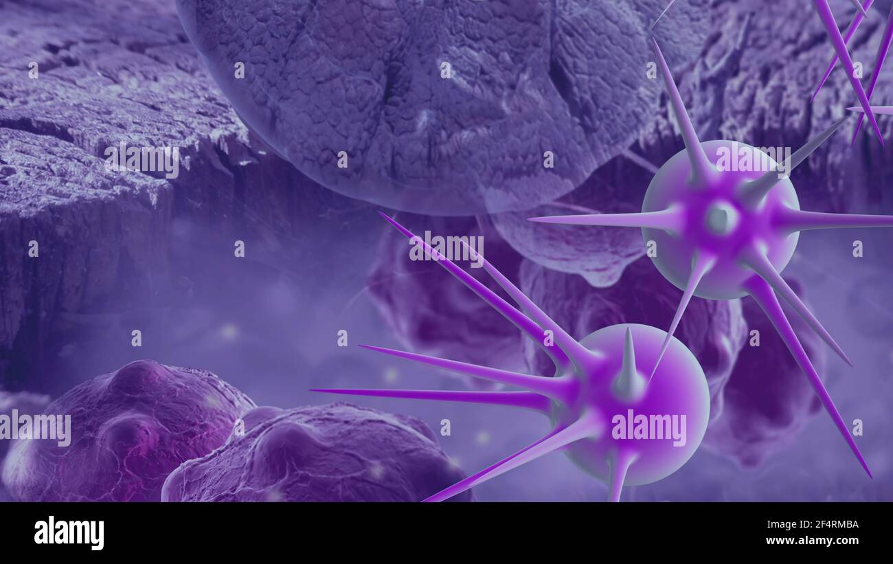 Human brain tumour cells hi-res stock photography and images - Alamy