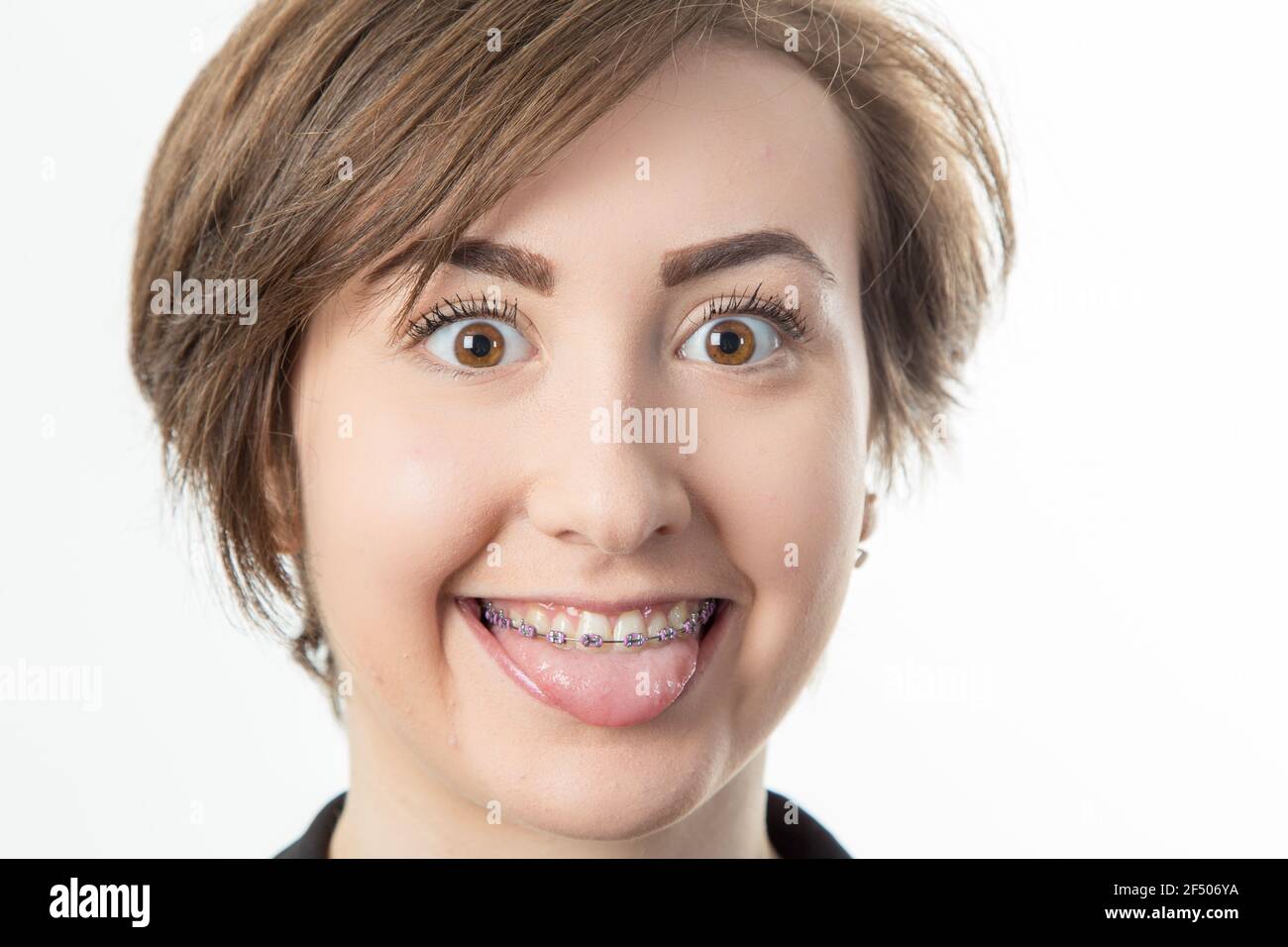 close-up of pretty dark haired teenage girl with braces sticking out her tounge Stock Photo
