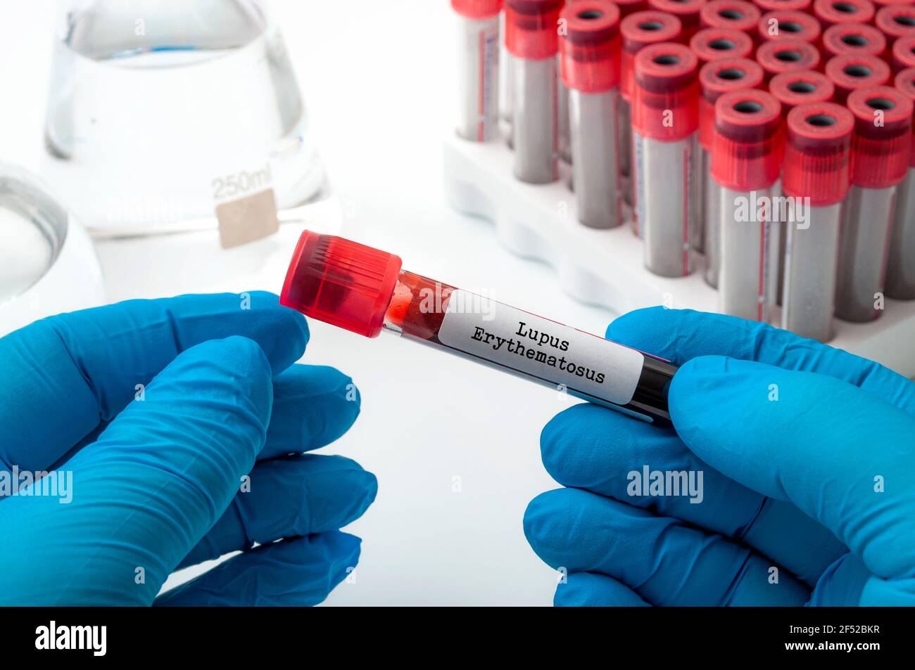 Science, medicine and pharmacy concept with doctor performing blood test on medical sample while wearing blue latex protection gloves in lab and holdi Stock Photo