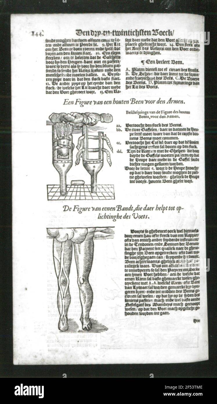 Leg prosthesis for arms and foot support tape. Textite with woodcuts of J.  Canin, 31.1 x 18.8 cm. From: DE Surgery End All DE Opera ..., Dortrecht,  1592. Dresden, Slub Surgeon.15.V Stock Photo - Alamy