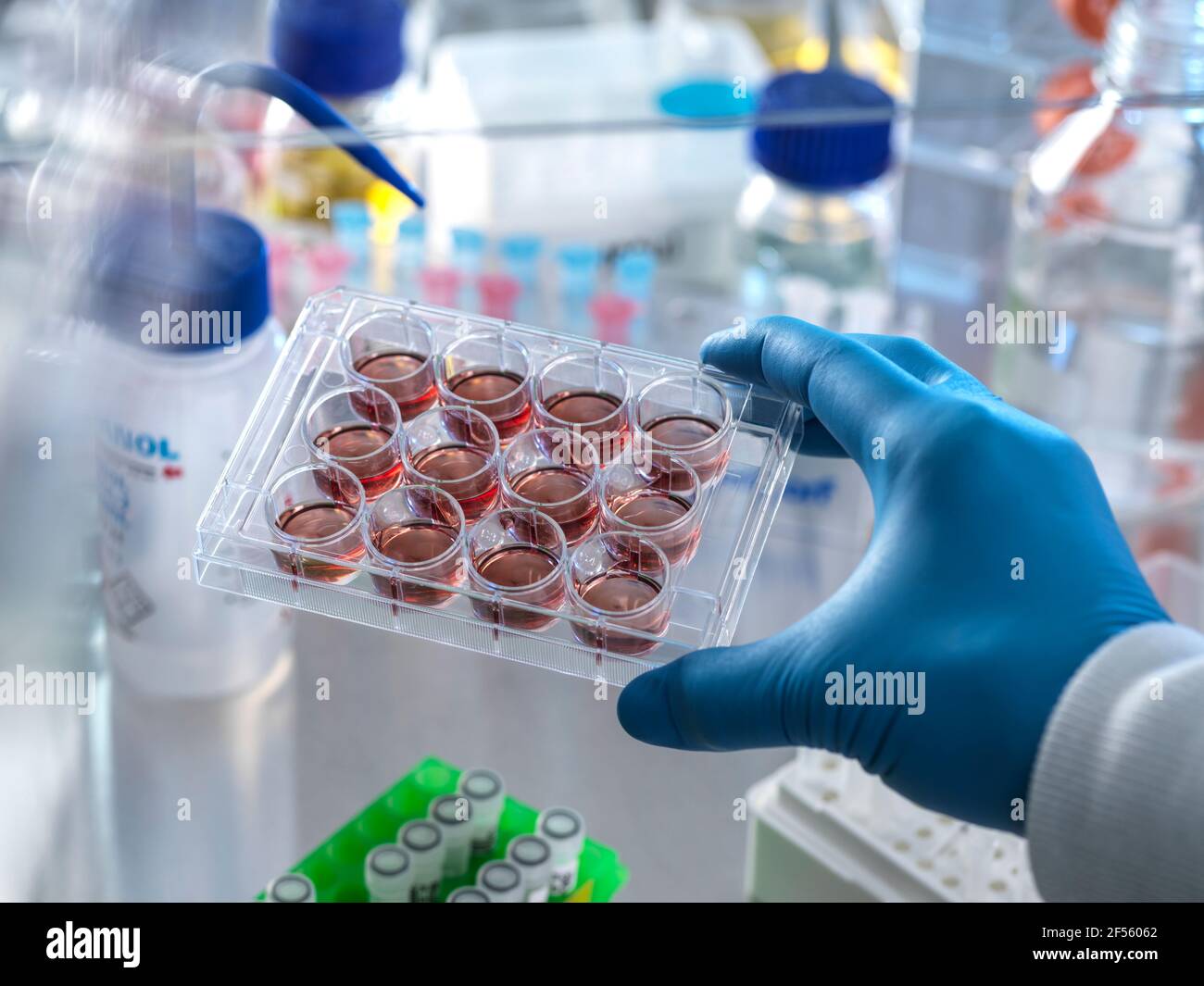 Scientist holding multi well plate with blood samples in fume hood Stock Photo