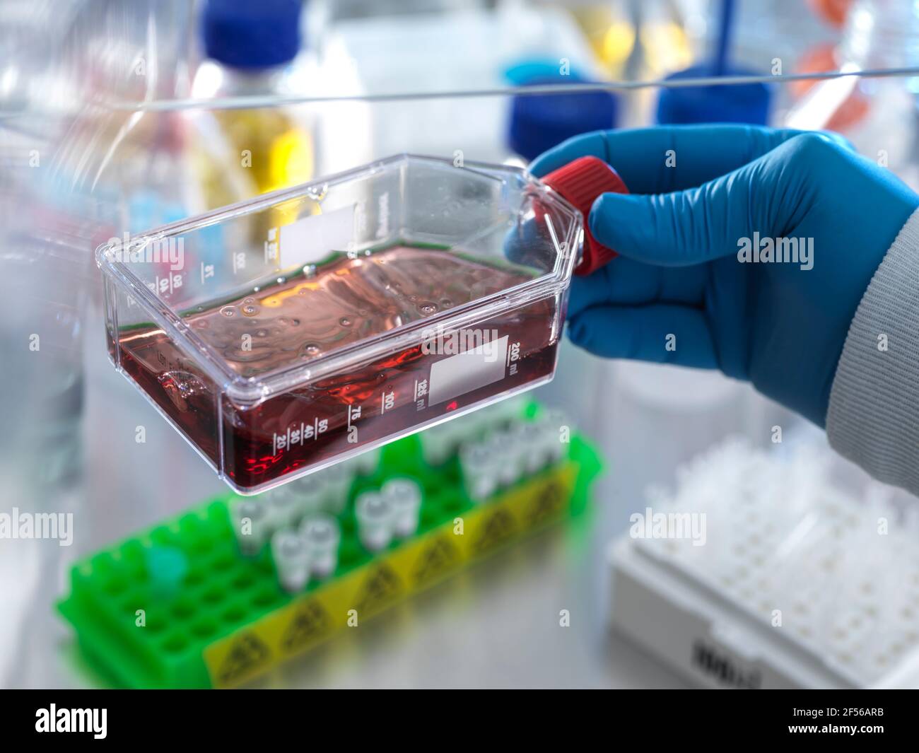 Technician holding jar containing blood cells while doing experiment in laboratory Stock Photo