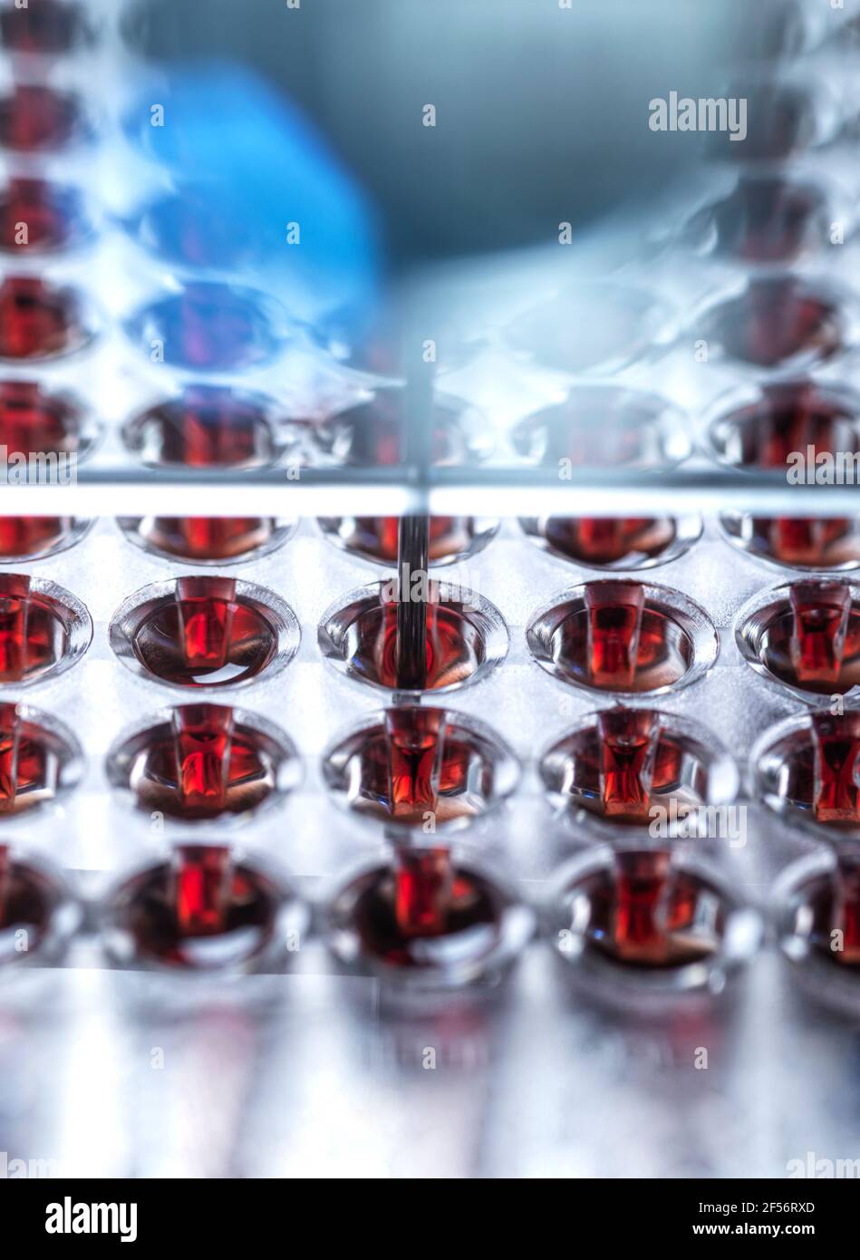 Blood samples for medical test in lab Stock Photo