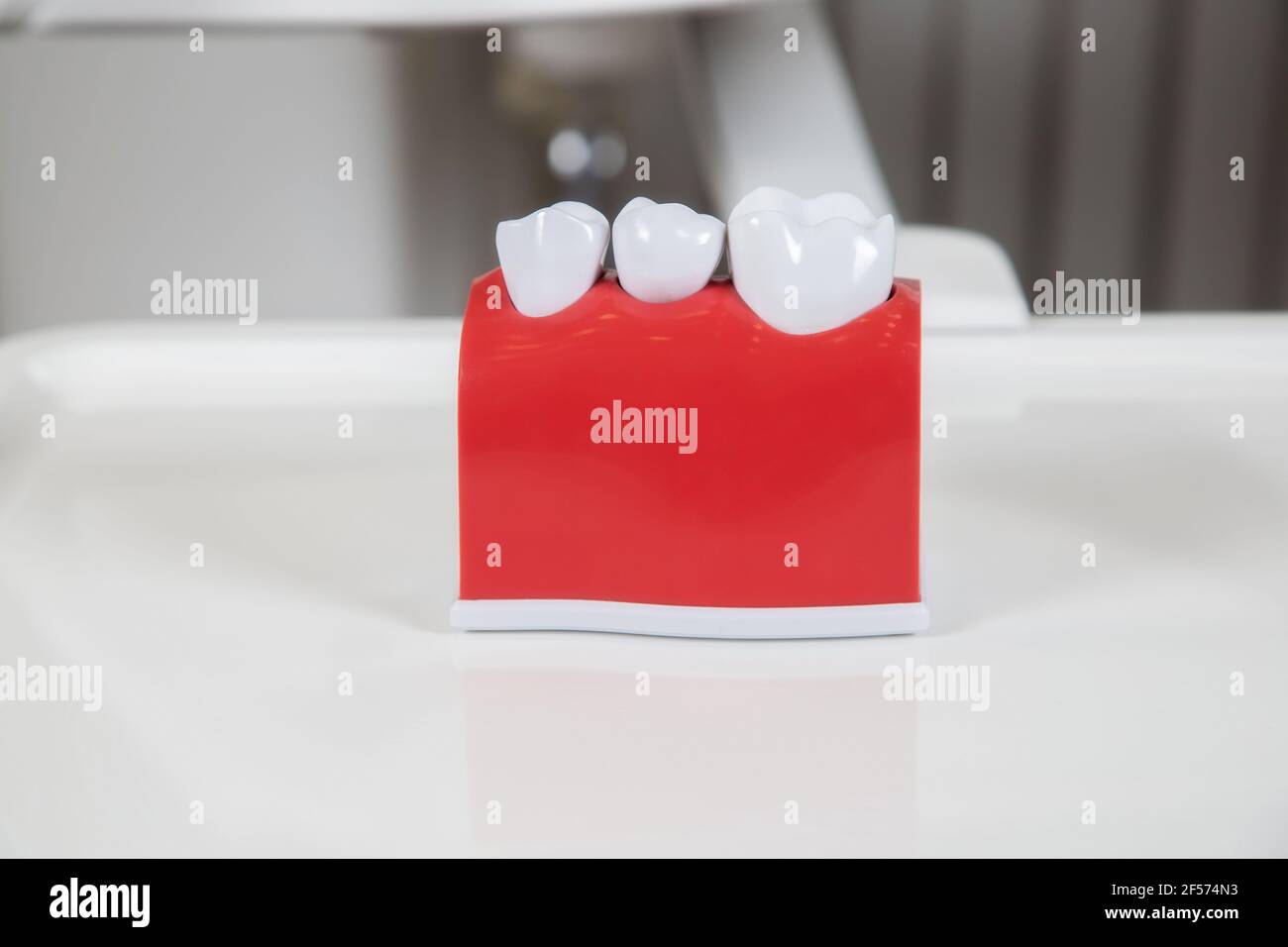 Plastic dental crowns, imitation of a dental prosthesis of a dental