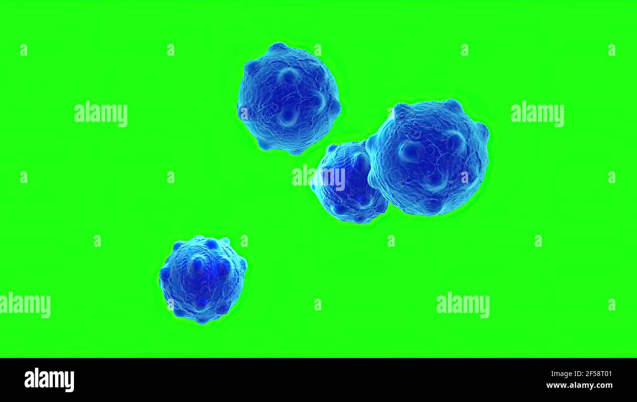 Human brain tumour cell hi-res stock photography and images - Alamy