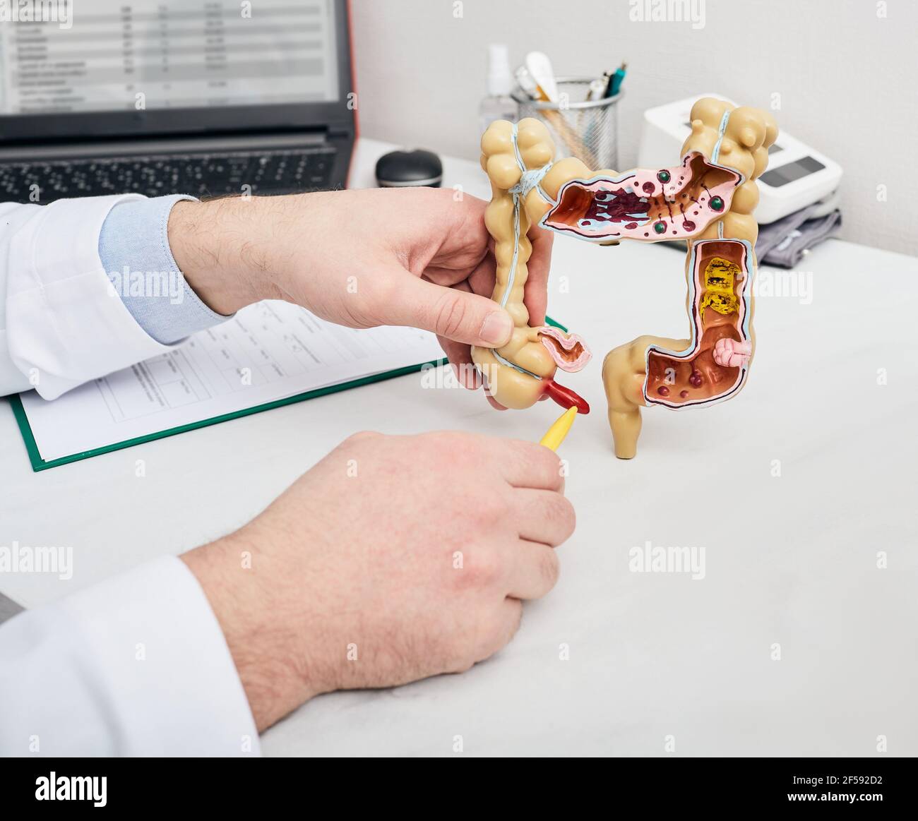 doctor pointing pen to inflamed appendicitis using a intestines anatomical model. Consultation gastroenterologist for a patient with stomach pain Stock Photo