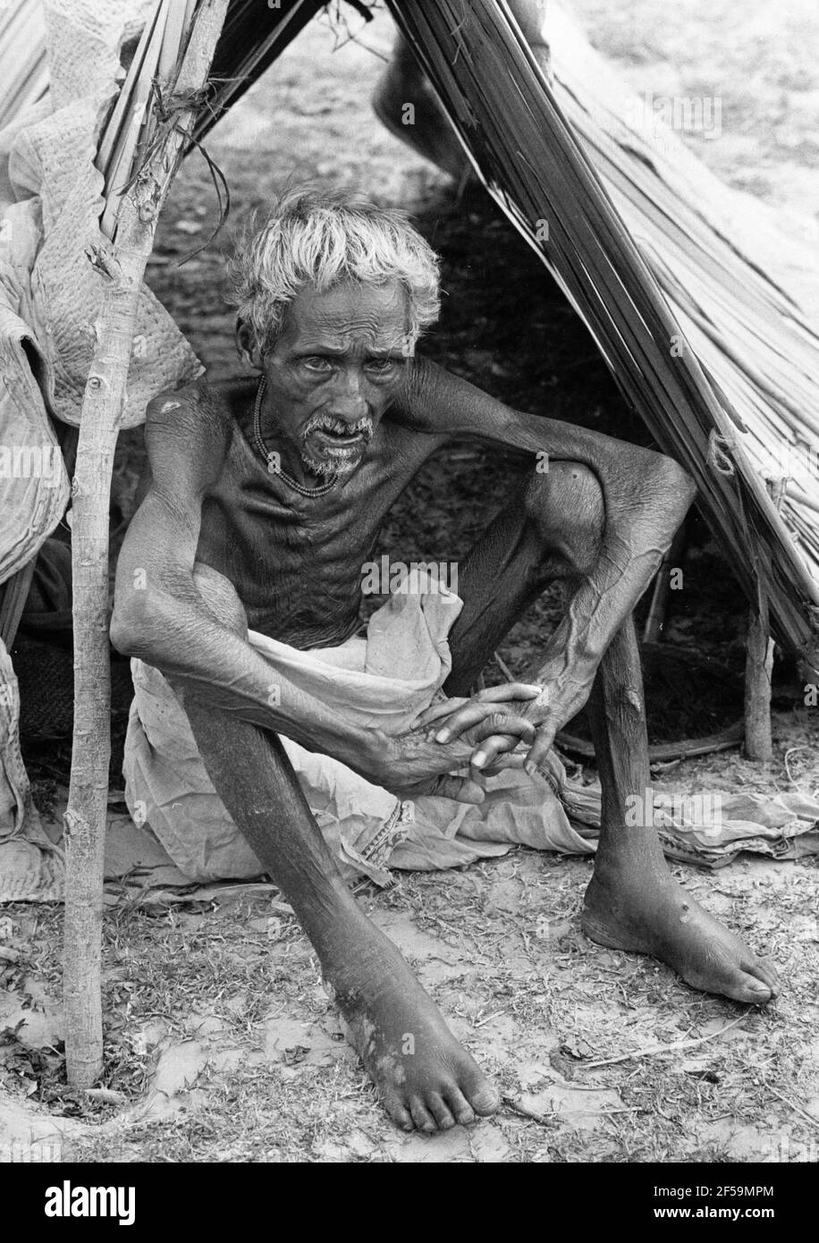 1971-06-24 An old man, suffering from cholera, sits under a dilapidated reed shelter in the Kalyani refugee camp.  Dressed in rags, they wander along the roads in the border region between East Pakistan and India. They belong to the army of the poor who have been forced to leave by West Pakistani troops. Their villages have been burnt down and in India, they are faced with new suffering.  Photo: Leif Engberg / DN / TT / code 15 Stock Photo