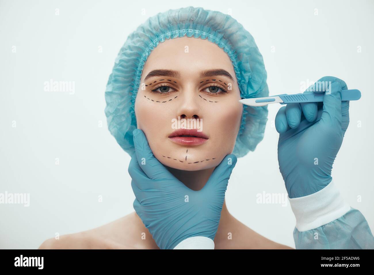 Face lift surgery. Portrait of beautiful young woman in blue medical hat having cosmetic face surgery. Plastic surgeon in blue gloves holding scalpel. Stock Photo