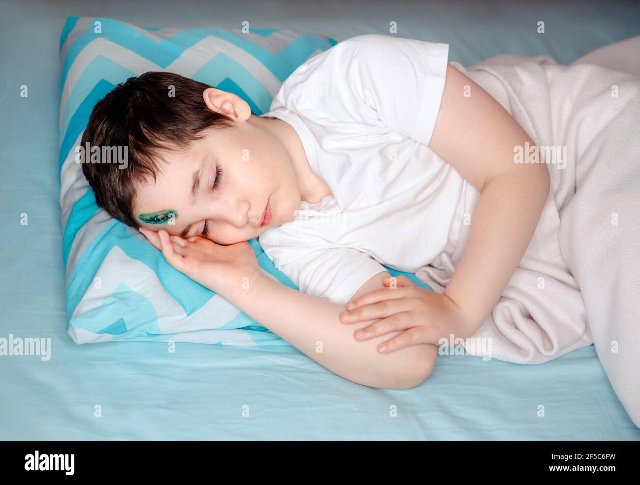 Child is lying in medical ward. Boy with a head contusion, deep cut Stock Photo
