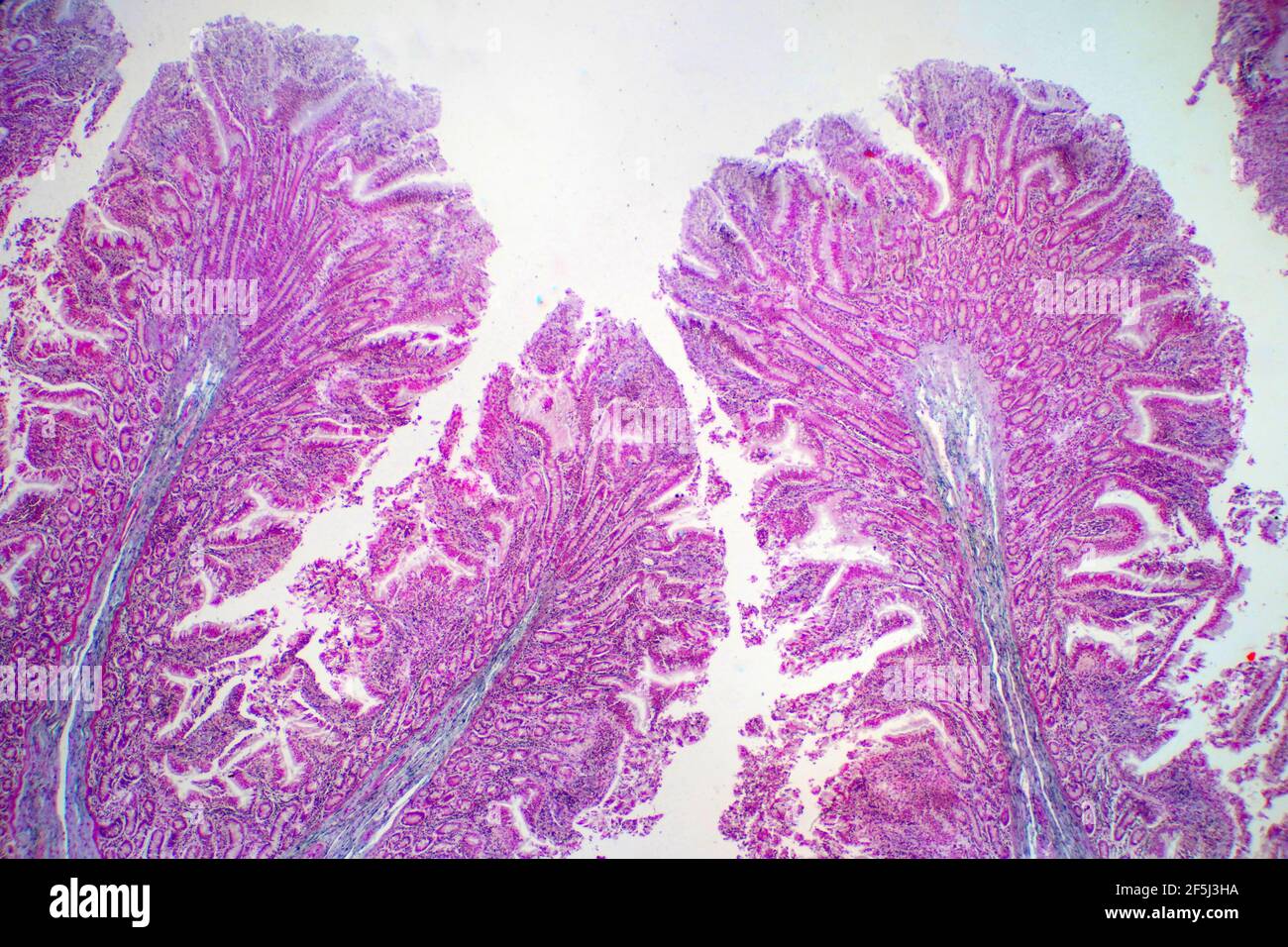 Human large intestine tissue, light micrograph Stock Photo