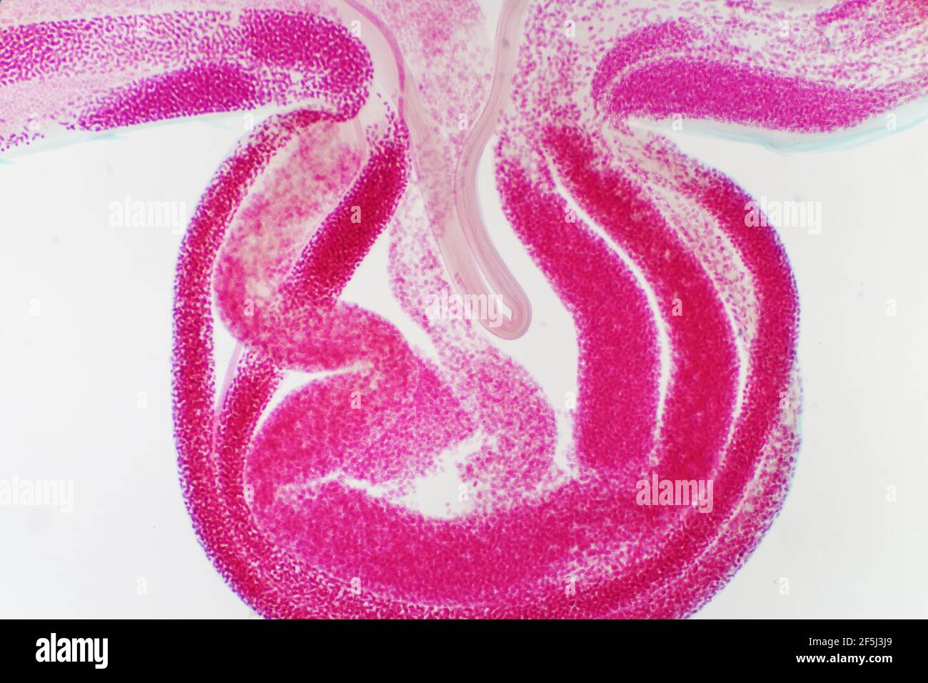 Dog roundworm eggs, light micrograph Stock Photo