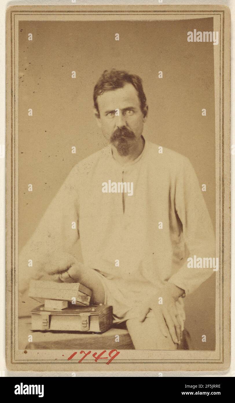 Unidentified Civil War victim with Vandyke beard, right leg amputated. Attributed to William H. Bell (American, 1830 - 1910) Stock Photo