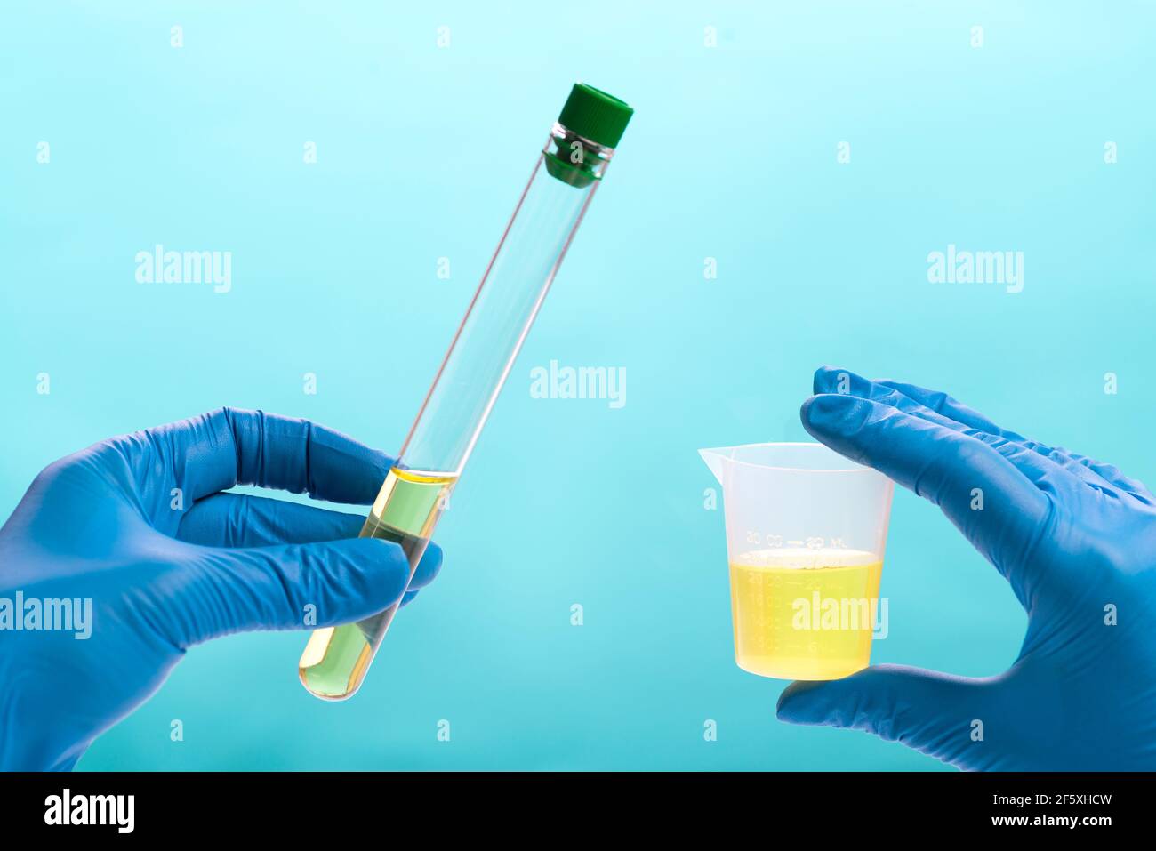 Urine analysis in the laboratory. Medical urine test. Urine sample for laboratory analysis Stock