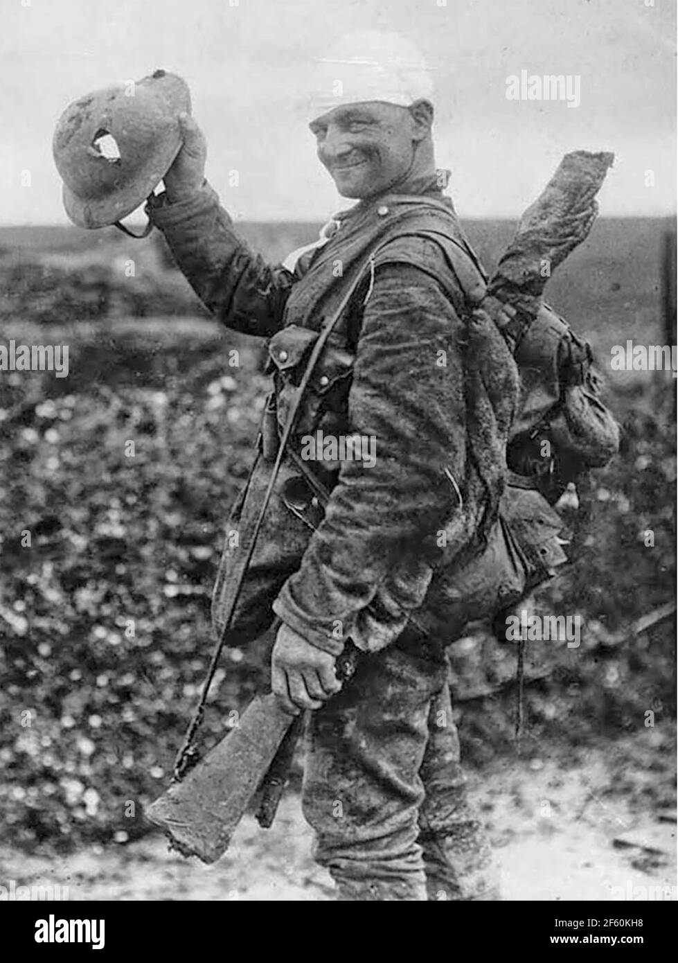 BRITISH SOLDIER shows of his damaged helmet in 1917. No other information found for this iconic photo. Stock Photo