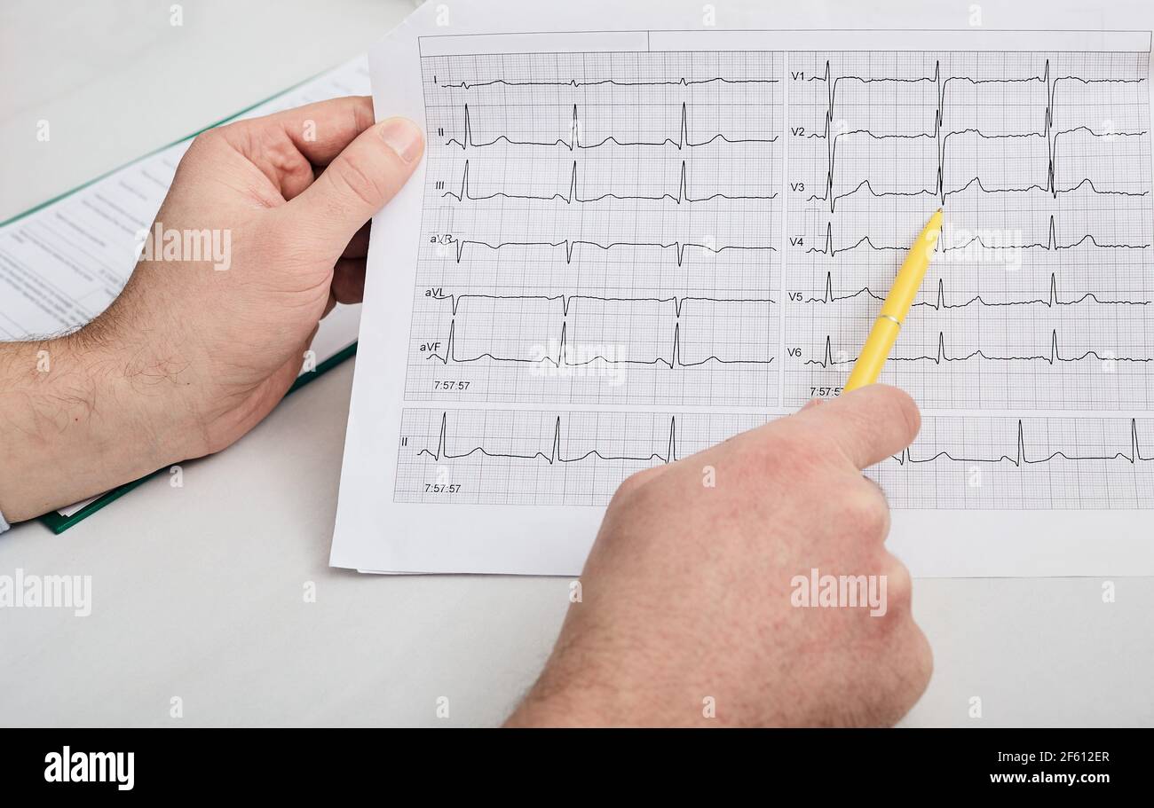 Cardiogram test, close-up of ECG report. doctor analyzes cardiogram results of a patient's heart for diagnosis and treatment of heart disease Stock Photo