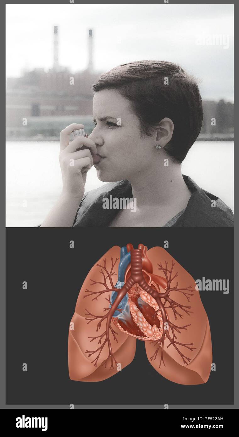 Young Woman Using an Inhaler Stock Photo