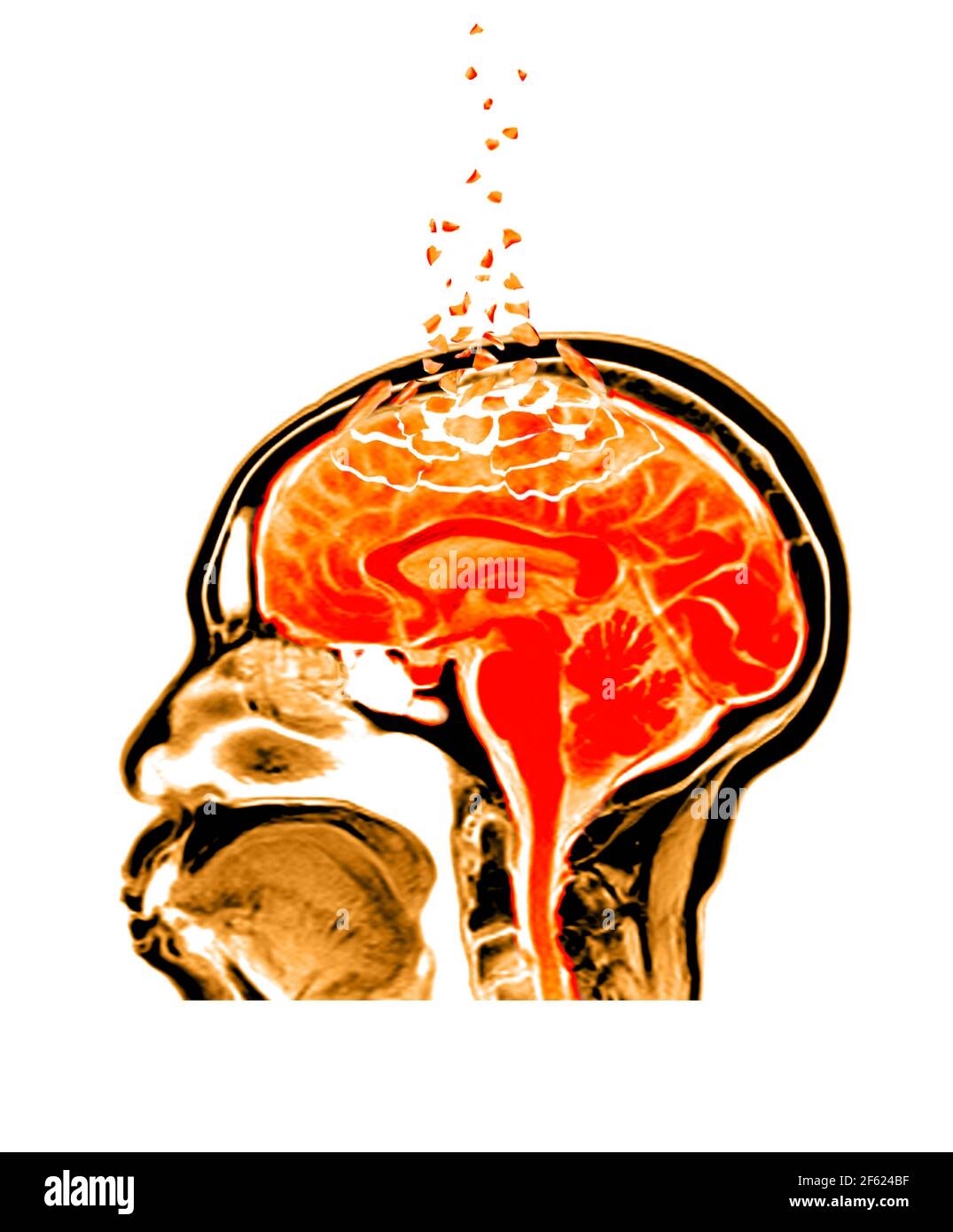 Neuroscience brain function hi-res stock photography and images - Alamy