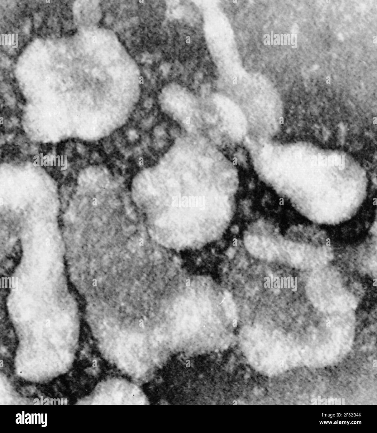 Micrograph of Coronavirus by June Almeida, 1966 Stock Photo