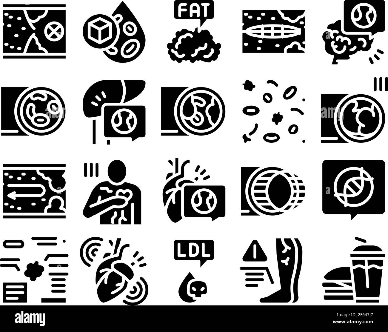 Atherosclerosis Vessel Glyph Set Vector Illustration Stock Vector