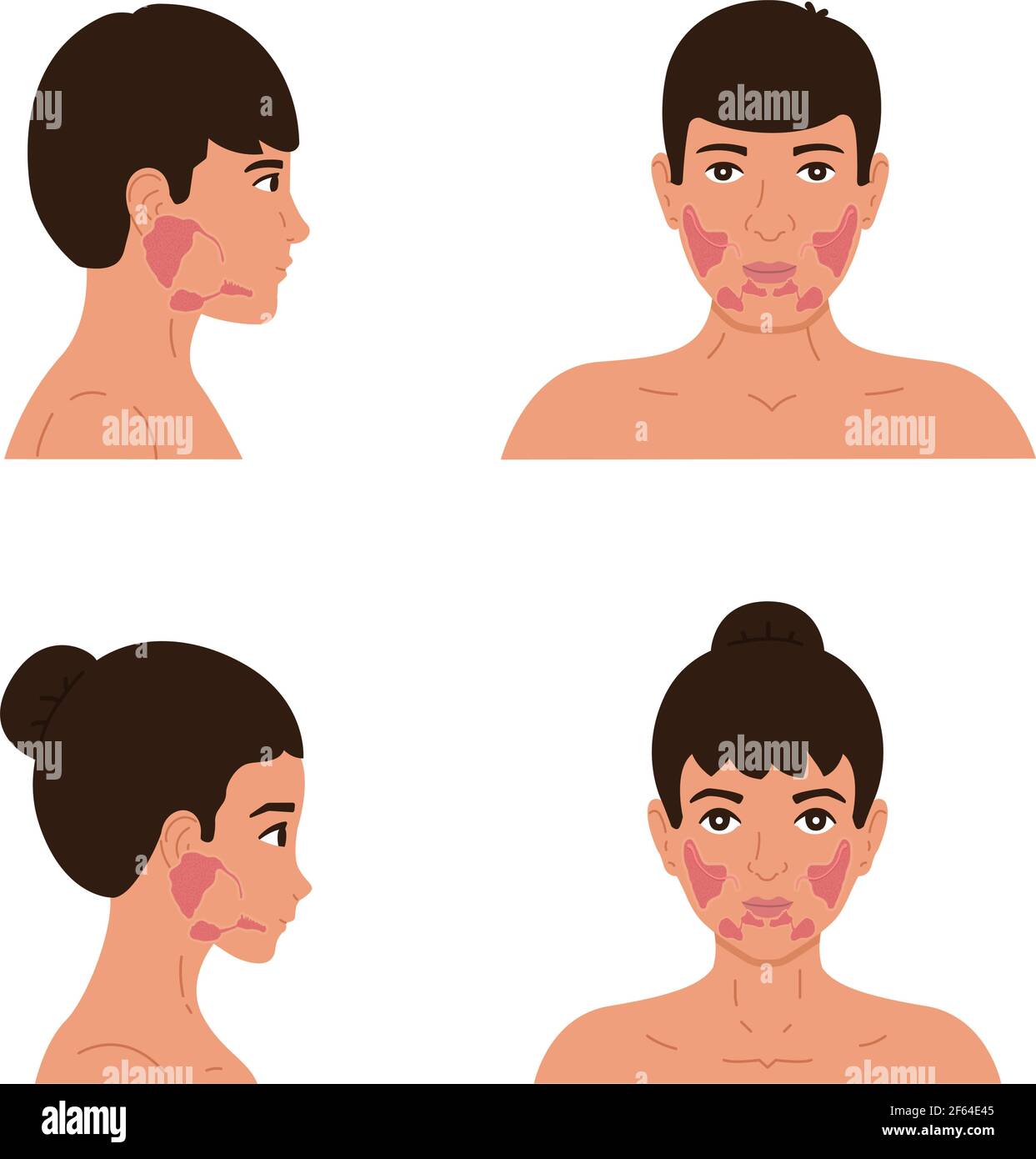 The location of the parotid, submandibular and sublingual salivary glands in the male and female body. Flat vector illustration of healthy salivary gl Stock Vector