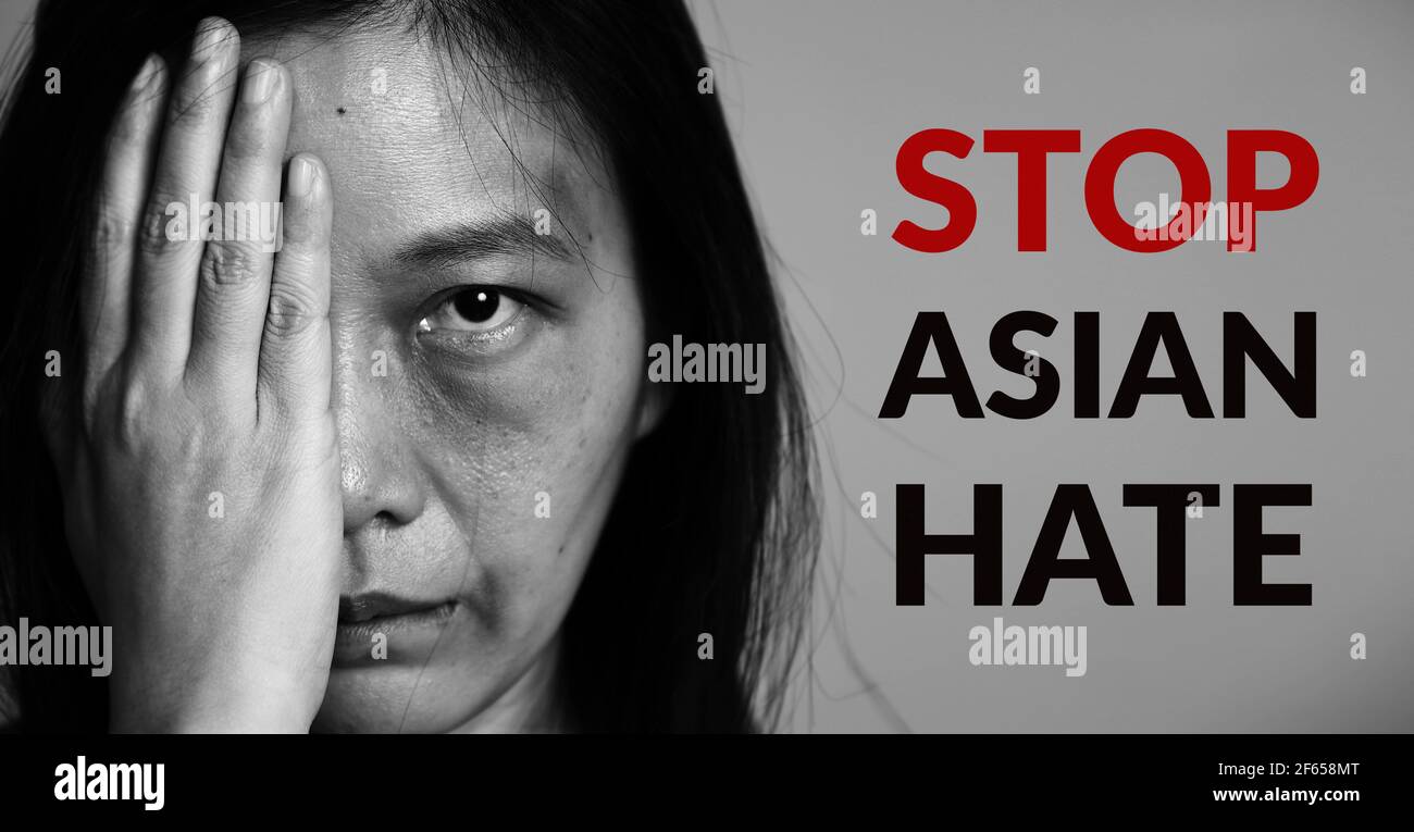 stop Asian hate poster campaign. Asia woman with bruise on arms and face, raise one hand and cover one face side. word stop Asian hate at copy space Stock Photo