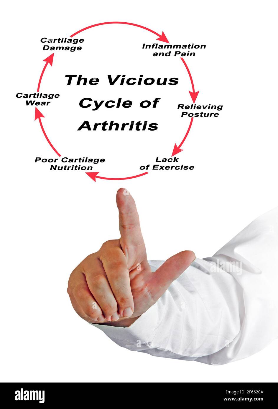 Steps in Vicious Cycle of Arthritis Stock Photo - Alamy